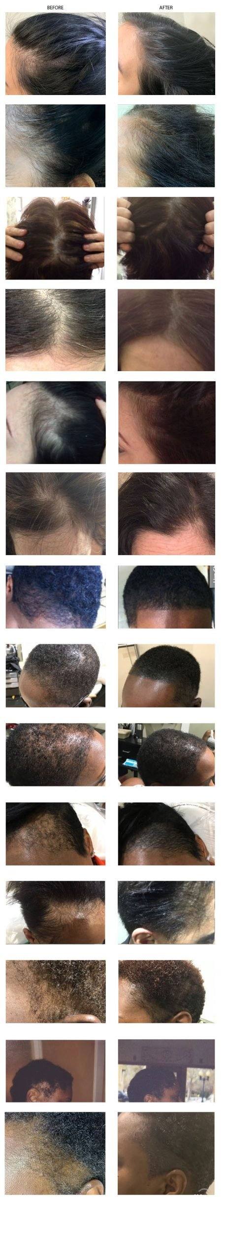 Women’s SMP – Permanent Makeup of Atlanta: updated Womens SMP